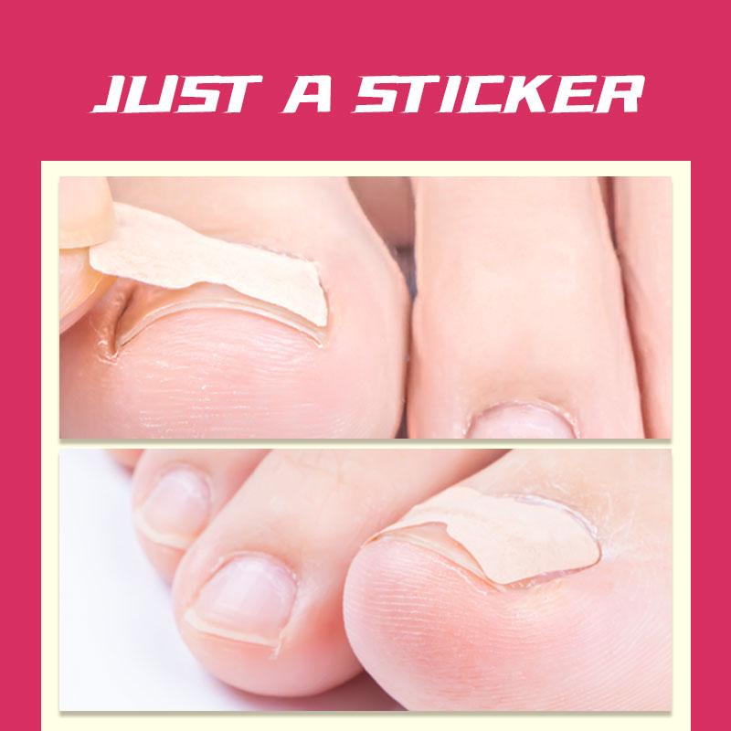 Fast Healing Toenail Patch (10pcs)