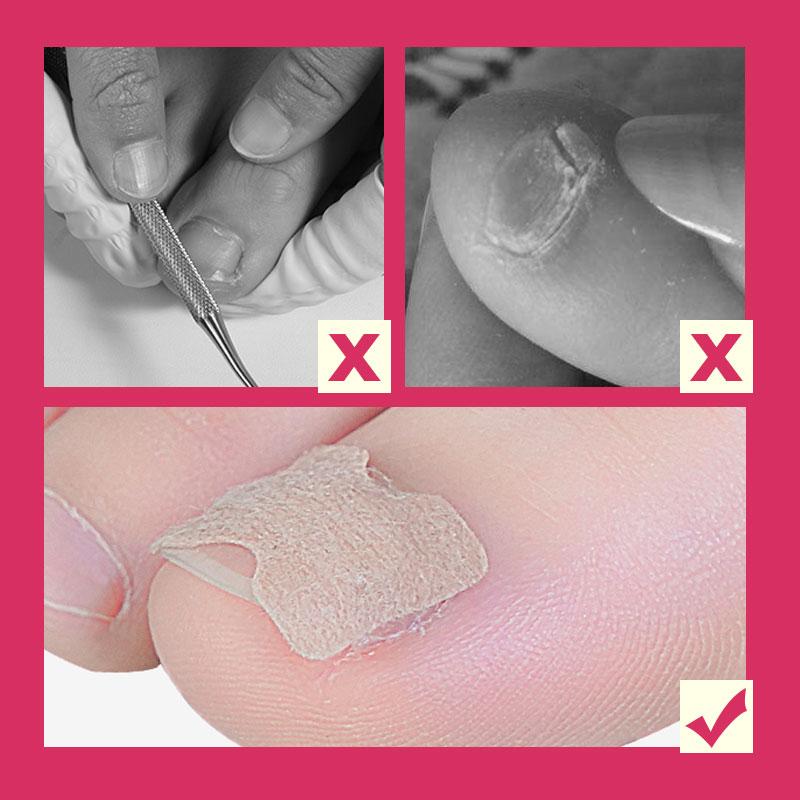 CORRECTION PATCHES FOR BEAUTIFUL AND HEALTHY NAILS